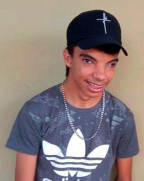 Jovem com s&iacute;ndrome rara cria vaquinha para arrecadar dinheiro para fazer cirurgia